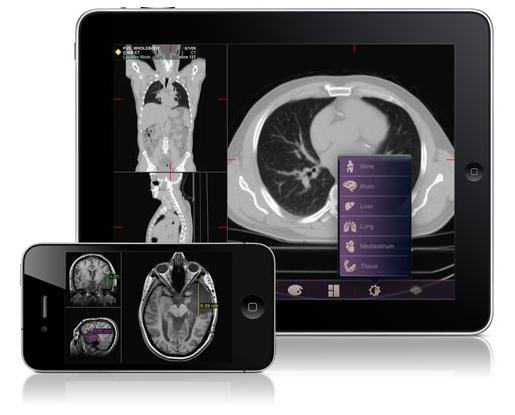 FDAͨ�^�ׂ��t(y��)���\�����ó���Mobile MIM